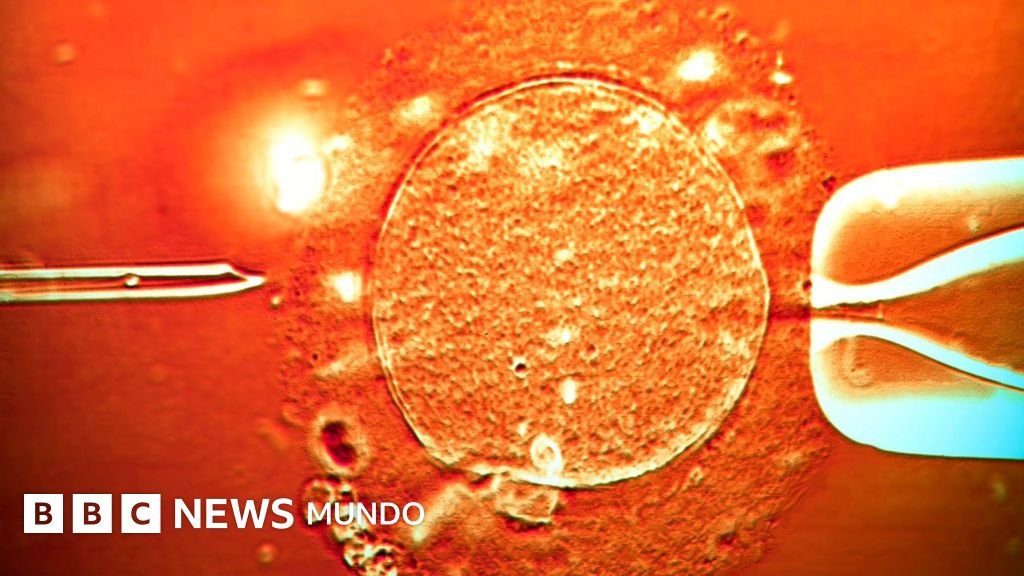 El uso de esperma de un donante portador de un gen cancerígeno para concebir casi 200 niños: "Algunos desarrollaron tumores y varios han fallecido"